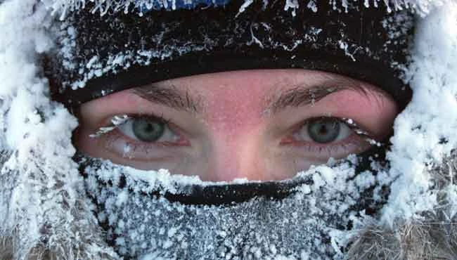 Kışın cildinizi kuruluk ve çatlaklardan korumanın tüyoları