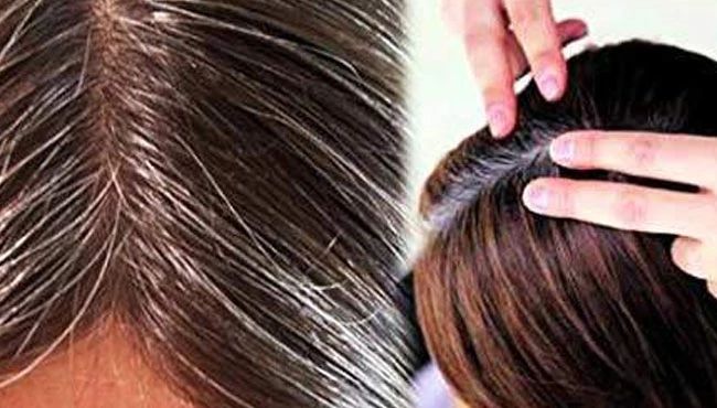 Saç beyazlamasını önlemenin doğal yolları
