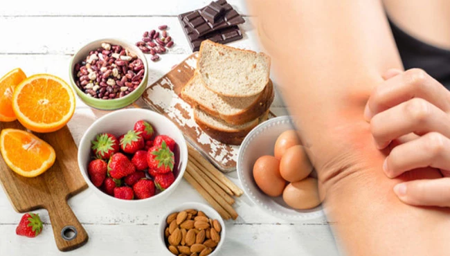 Besin alerjisine karşı günlük tutun